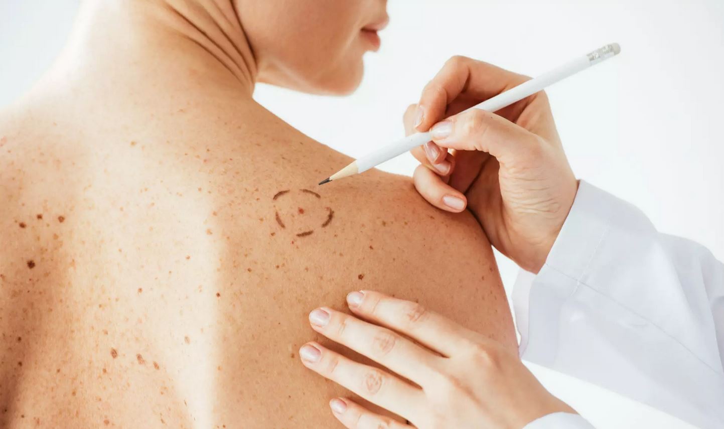 en iyi cildiye doktoru dermatolog